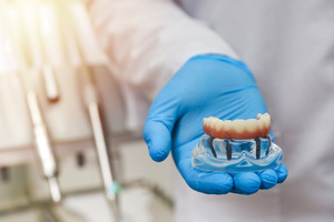 Gloved hand holding a dental implant model